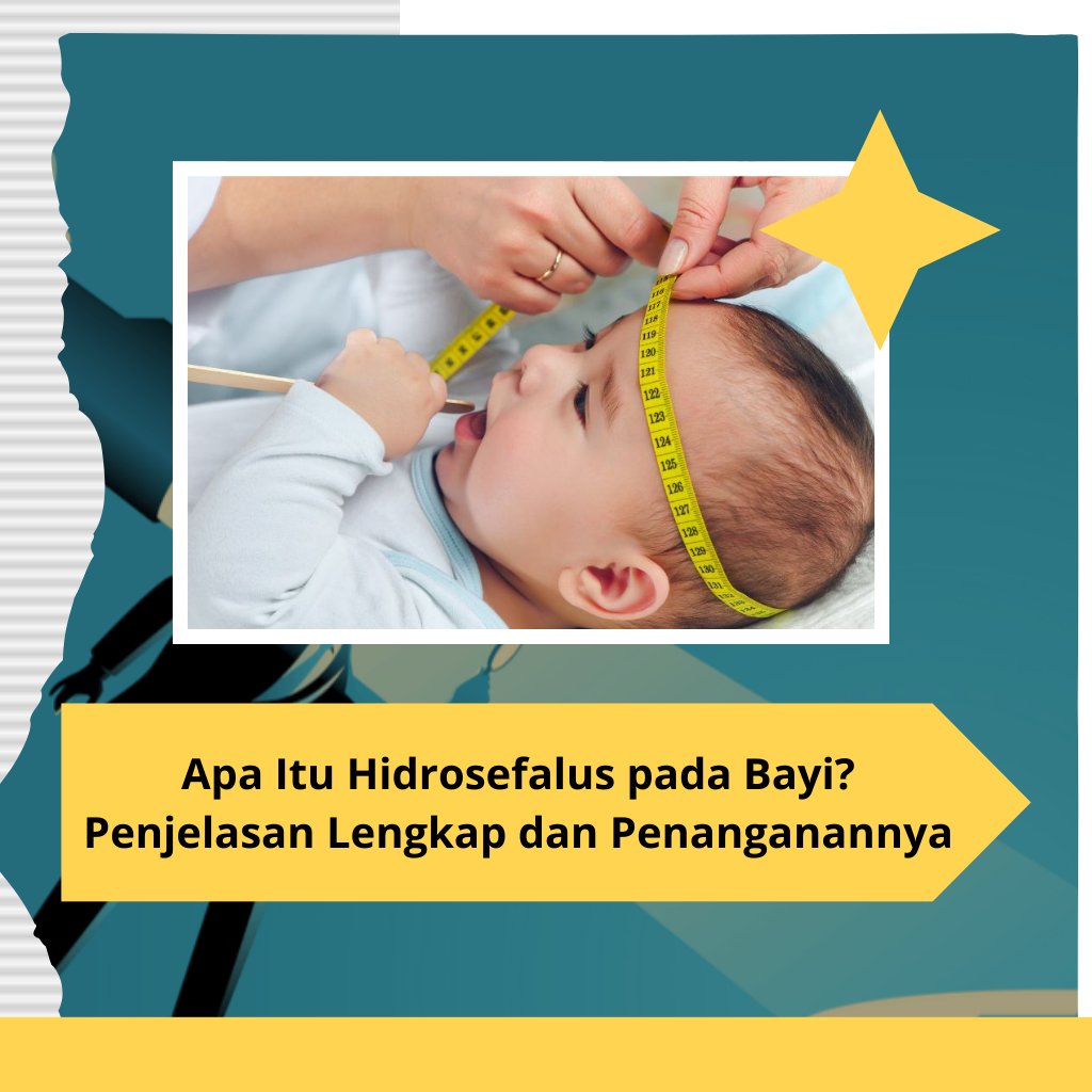Apa Itu Hidrosefalus pada Bayi? Penjelasan Lengkap dan Penanganannya