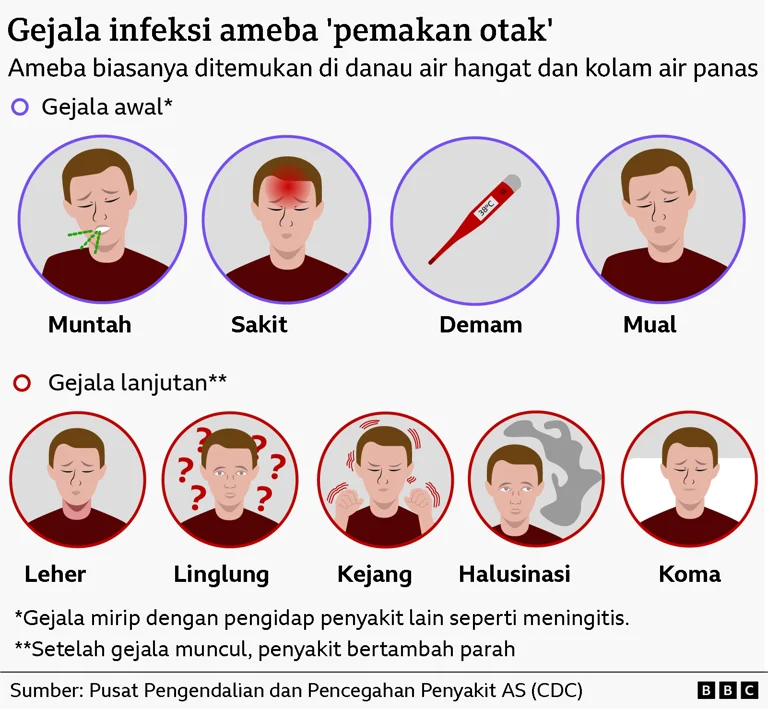 Rasanya seperti film horor - Ameba 'pemakan otak' yang telah menyebar ke seluruh dunia, Piala Dunia 2026 Jadi Sorotan
