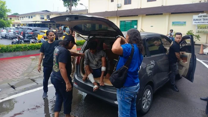 Bikin Konten Seolah Jadi Korban Begal Hingga Jari Tangan Putus, Bayu Jadi Berurusan dengan Polisi